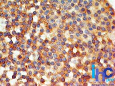 Immunohistochemistry-Paraffin: TLR6 Antibody (86B1153.2) - BSA Free [NB100-56536]