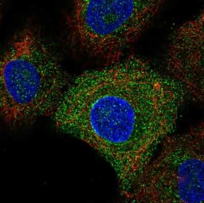 Immunocytochemistry/ Immunofluorescence: TLR6 Antibody [NBP2-57646]