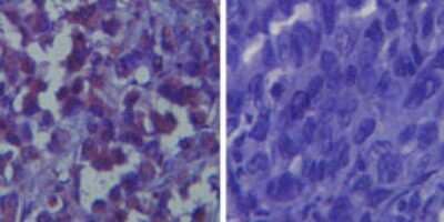 Immunohistochemistry-Paraffin: TLR6 Antibody [NBP2-24914]