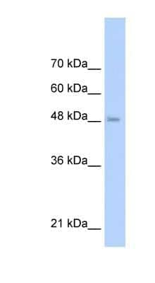 Western Blot: TLR6 Antibody [NBP1-54336]