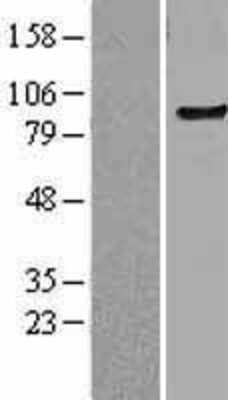 Western Blot: TLR6 Overexpression Lysate [NBL1-16955]