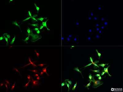Immunocytochemistry/ Immunofluorescence: TLR7 Antibody - Azide Free [NBP2-24905]