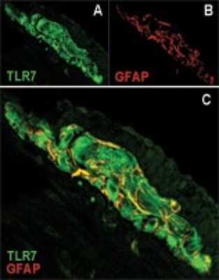 Immunocytochemistry/ Immunofluorescence: TLR7 Antibody - Azide Free [NBP2-24905]