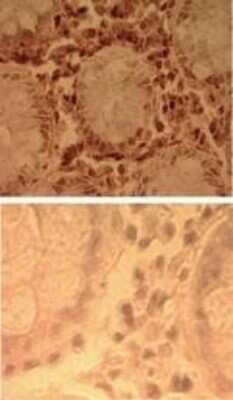 Immunohistochemistry-Paraffin: TLR7 Antibody - Azide Free [NBP2-24905]