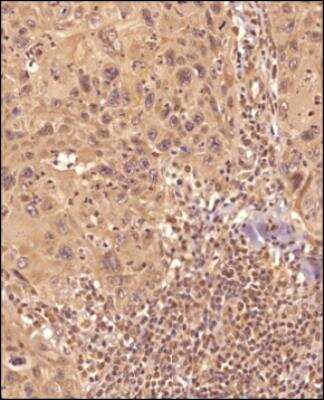 Immunohistochemistry-Paraffin: TLR7 Antibody - BSA Free [NBP2-24906]