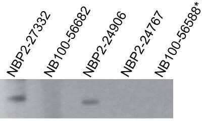 Western Blot: TLR7 Antibody (4G6)Azide and BSA Free [NBP2-80982]