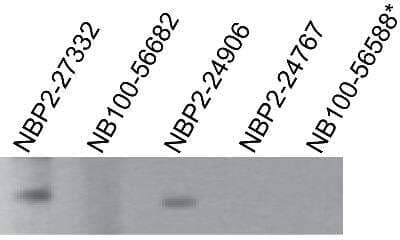Western Blot: TLR7 Antibody (4G6)BSA Free [NBP2-27332]