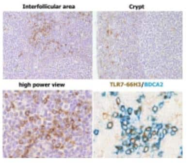 Immunohistochemistry: TLR7 Antibody (66H3) [DDX0500P-100]