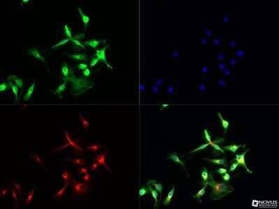 Immunocytochemistry/ Immunofluorescence: TLR7 Antibody - BSA Free [NBP2-24906]