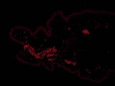 Immunohistochemistry-Frozen: TLR7 Antibody - BSA Free [NBP2-24906]