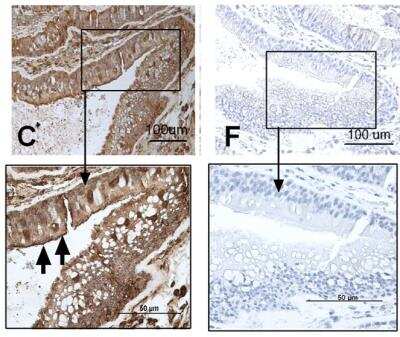 Immunohistochemistry: TLR7 Antibody [NB100-56682]