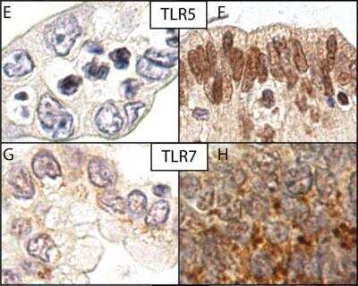 Immunohistochemistry: TLR7 Antibody - BSA Free [NBP2-24906]