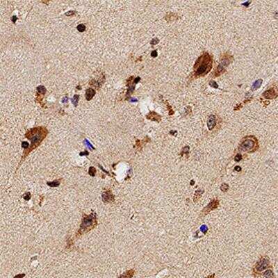 Immunohistochemistry-Paraffin: TLR7 Antibody [NB100-56588]
