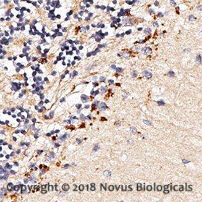 Immunohistochemistry-Paraffin: TLR7 Antibody [NBP2-24767]
