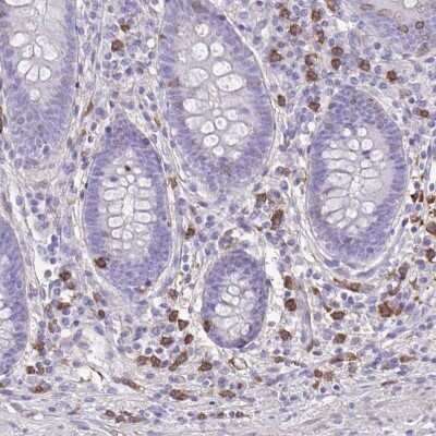 Immunohistochemistry-Paraffin: TLR7 Antibody [NBP2-32483]