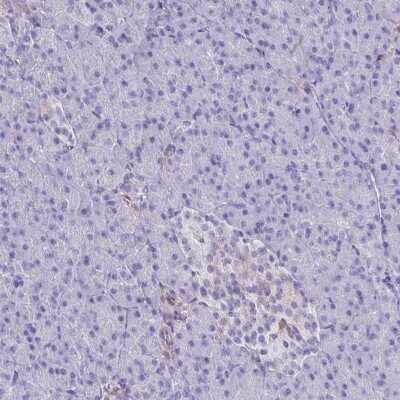 Immunohistochemistry-Paraffin: TLR7 Antibody [NBP2-32483]