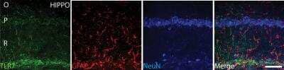 Immunohistochemistry: TLR7 Antibody Pack [NBP2-31097]