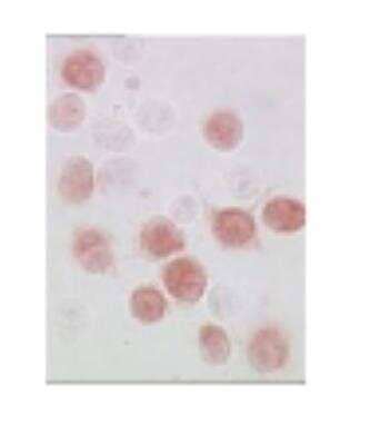 Immunohistochemistry: TLR8 Antibody (303F1.14) [DDX0480P-100]