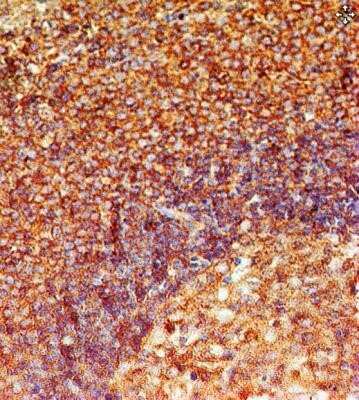 Immunohistochemistry-Paraffin: TLR8 Antibody (44C143) - Azide and BSA Free [NBP2-77073]