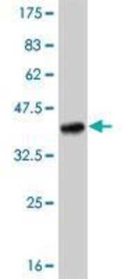 Western Blot: TLR8 Antibody (4C6) [H00051311-M01]