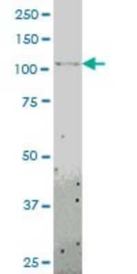 Western Blot: TLR8 Antibody (4C6) [H00051311-M01]