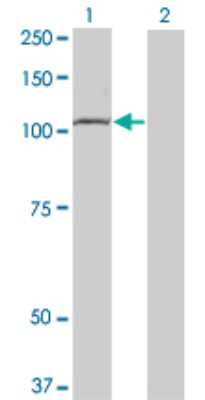 Western Blot: TLR8 Antibody (4C6) [H00051311-M01]