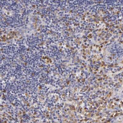 Immunohistochemistry-Paraffin: TLR8 Antibody [NBP1-85767]