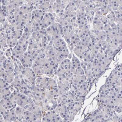 Immunohistochemistry-Paraffin: TLR8 Antibody [NBP1-85767]