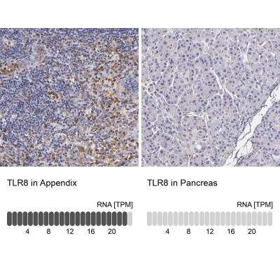 Immunohistochemistry-Paraffin: TLR8 Antibody [NBP1-85767]