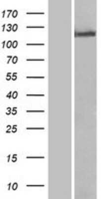 Western Blot: TLR8 Overexpression Lysate [NBP2-05618]