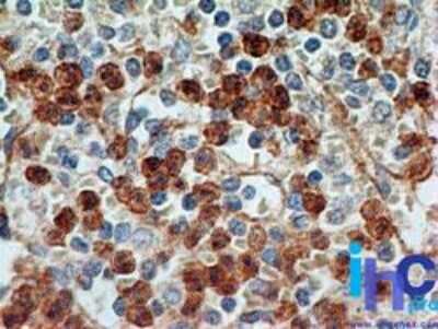 Immunohistochemistry-Paraffin: TLR9 Antibody (26C593.2) - Azide Free [NBP2-24863]