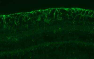 Immunohistochemistry-Paraffin: TLR9 Antibody (26C593.2) - BSA Free [NBP2-24729]