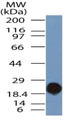 Western Blot: TLR9 Antibody (2A4C6.2E5)Azide and BSA Free [NBP2-80983]