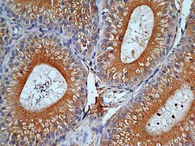 Immunohistochemistry-Paraffin: TLR9 Antibody (2A4C6.2E5) - BSA Free [NBP2-31150]