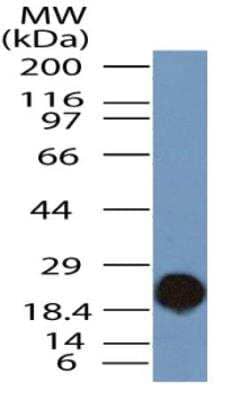 Western Blot: TLR9 Antibody (2A4C6.2E5)BSA Free [NBP2-31150]