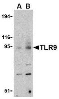 Western Blot: TLR9 AntibodyBSA Free [NBP1-77254]