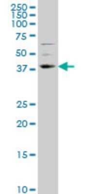 Western Blot: TLX/NR2E1 Antibody (1C4) [H00007101-M01]