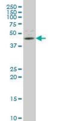 Western Blot: TLX/NR2E1 Antibody (4D2) [H00007101-M06]