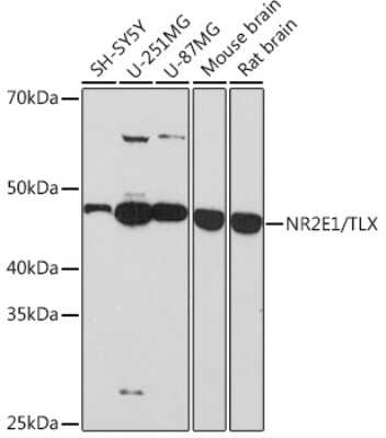 Western Blot: TLX/NR2E1 Antibody (6P3H8) [NBP3-16504]