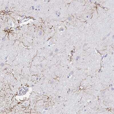 Immunohistochemistry-Paraffin: TLX/NR2E1 Antibody [NBP2-38764]