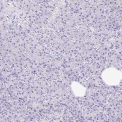 Immunohistochemistry-Paraffin: TLX/NR2E1 Antibody [NBP2-38764]