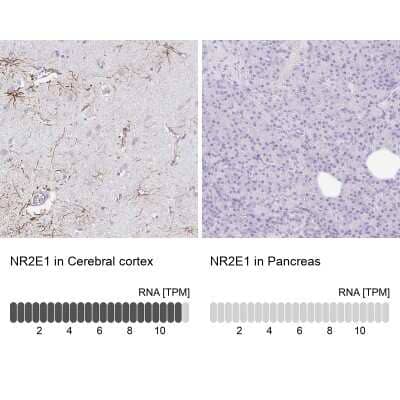 Immunohistochemistry-Paraffin: TLX/NR2E1 Antibody [NBP2-38764]