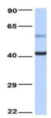 Western Blot: TLX/NR2E1 Antibody [NBP3-10924]