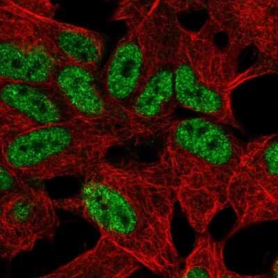 Immunocytochemistry/ Immunofluorescence: TLX2 Antibody [NBP2-56470]