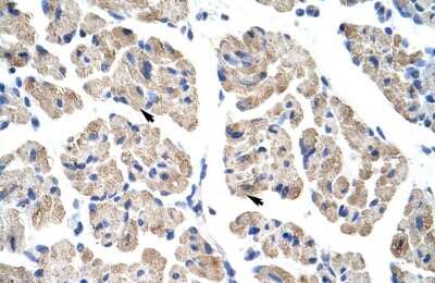 Immunohistochemistry: TLX2 Antibody [NBP2-85926]