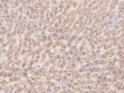 Immunohistochemistry-Paraffin: TLX2 Antibody [NBP2-98149]