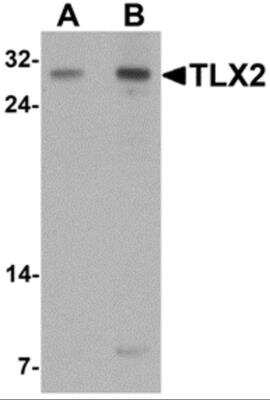 Western Blot: TLX2 AntibodyBSA Free [NBP2-82023]