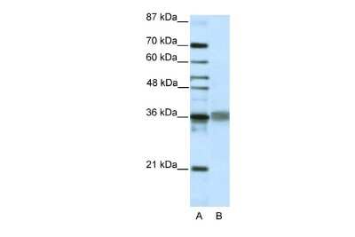 Western Blot: TLX2 Antibody [NBP2-85926]