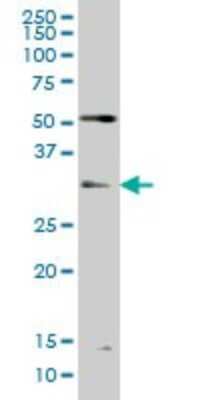 Western Blot: TLX3 Antibody (2A3) [H00030012-M01]