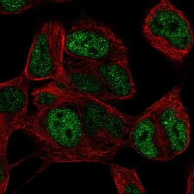 Immunocytochemistry/ Immunofluorescence: TLX3 Antibody [NBP2-68618]